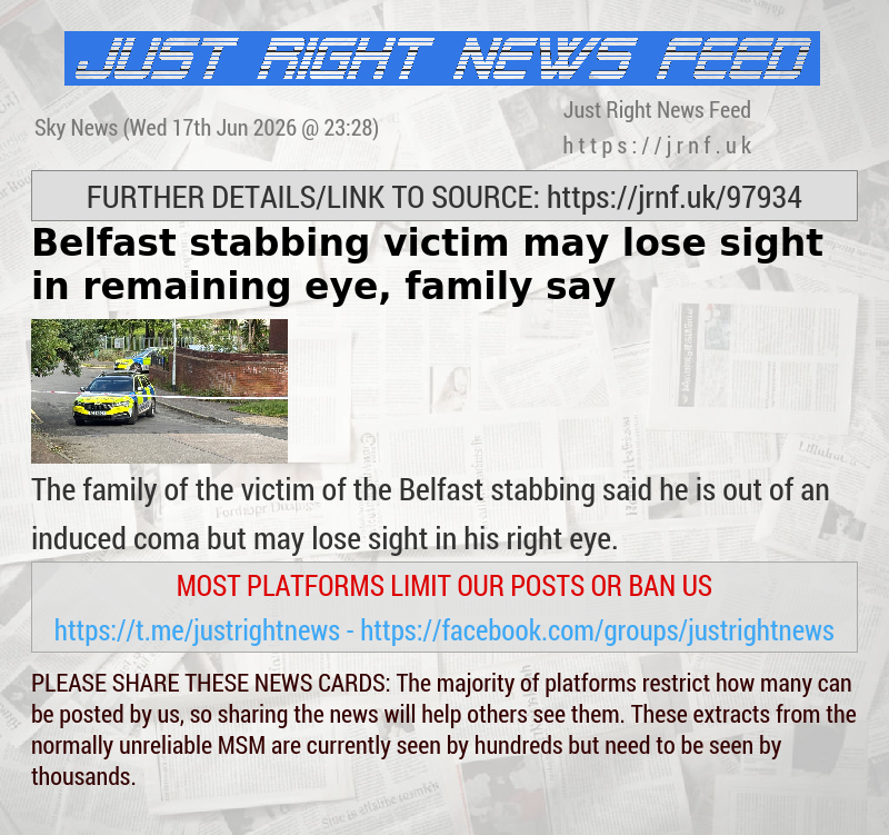 Belfast stabbing victim may lose sight in remaining eye, family say