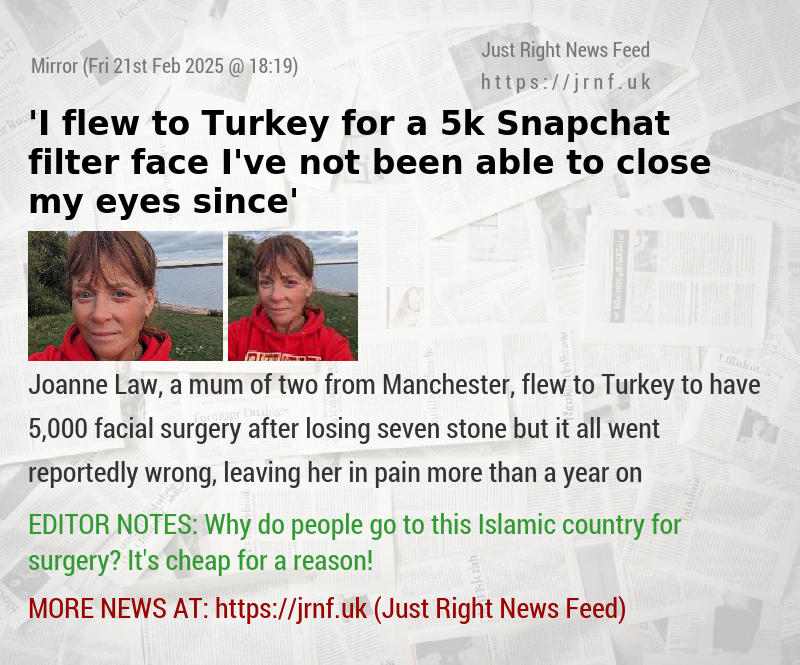 ’I flew to Turkey for a 5k Snapchat filter face — I’ve not been able to close my eyes since’