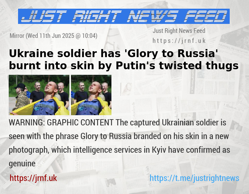 Ukraine soldier has ’Glory to Russia’ burnt into skin by Putin’s twisted thugs