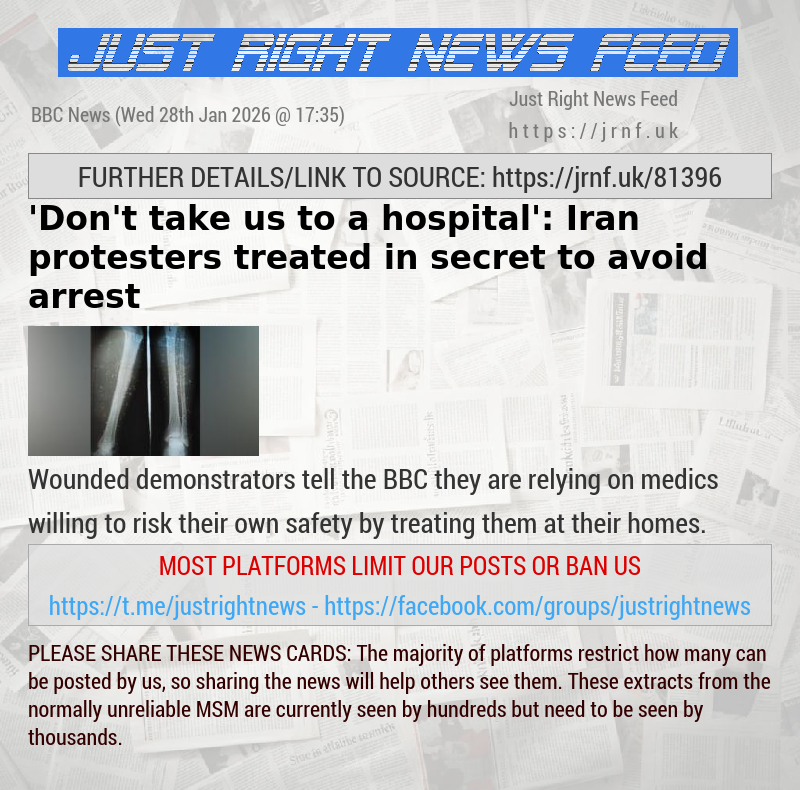 ’Don’t take us to a hospital’: Iran protesters treated in secret to avoid arrest