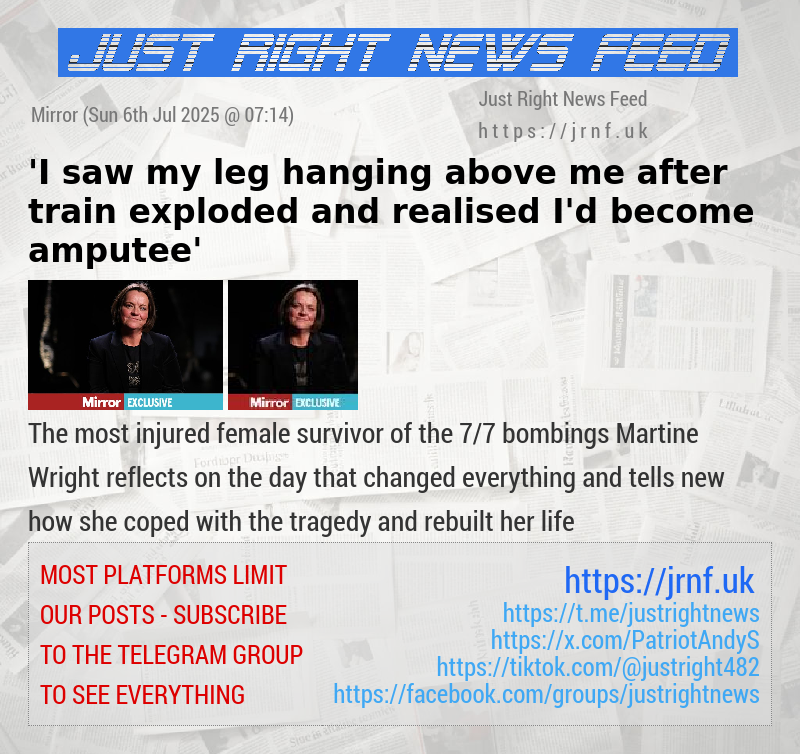 ’I saw my leg hanging above me after train exploded and realised I’d become amputee’