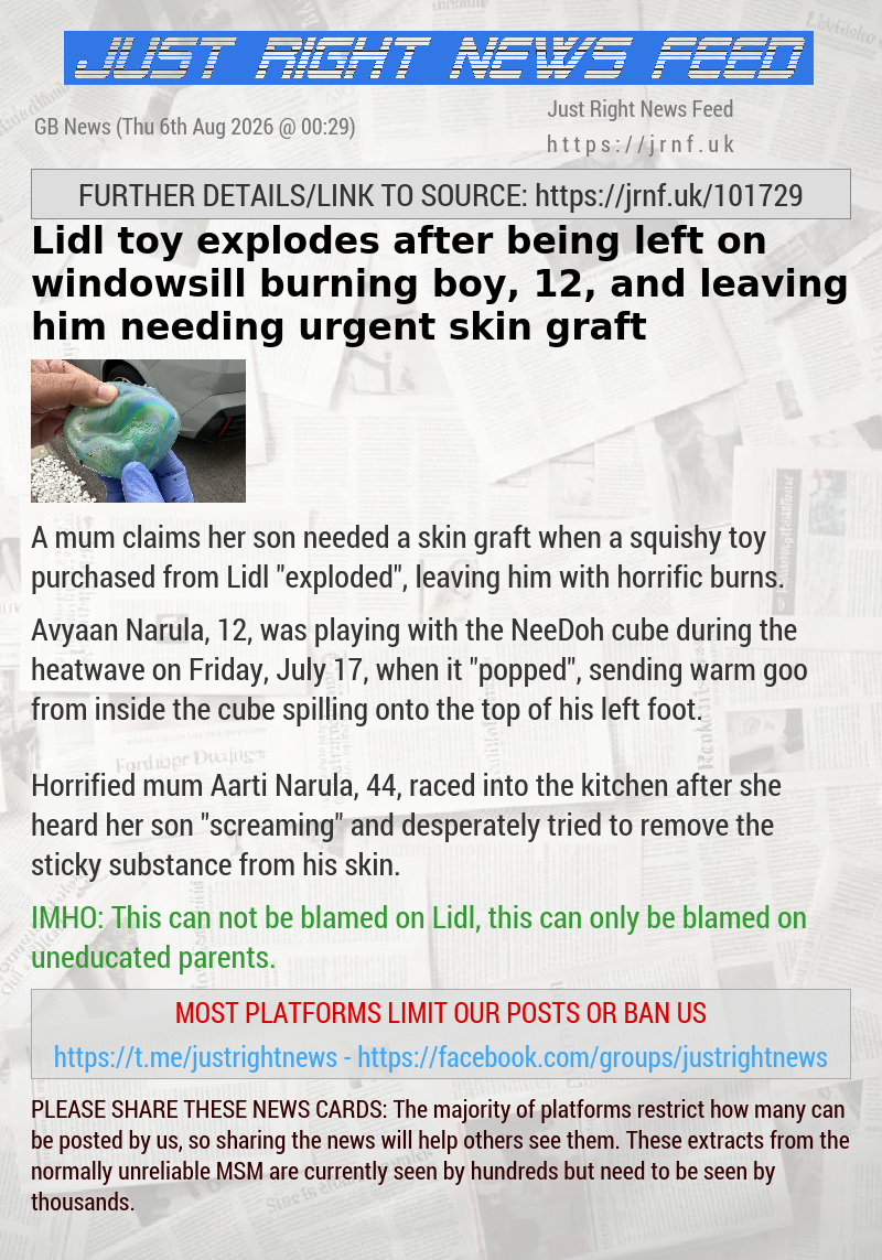 Lidl toy explodes after being left on windowsill burning boy, 12, and leaving him needing urgent skin graft