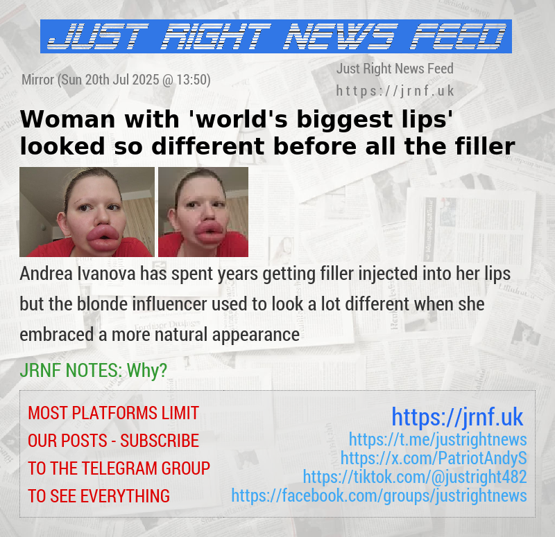 Woman with ’world’s biggest lips’ looked so different before all the filler
