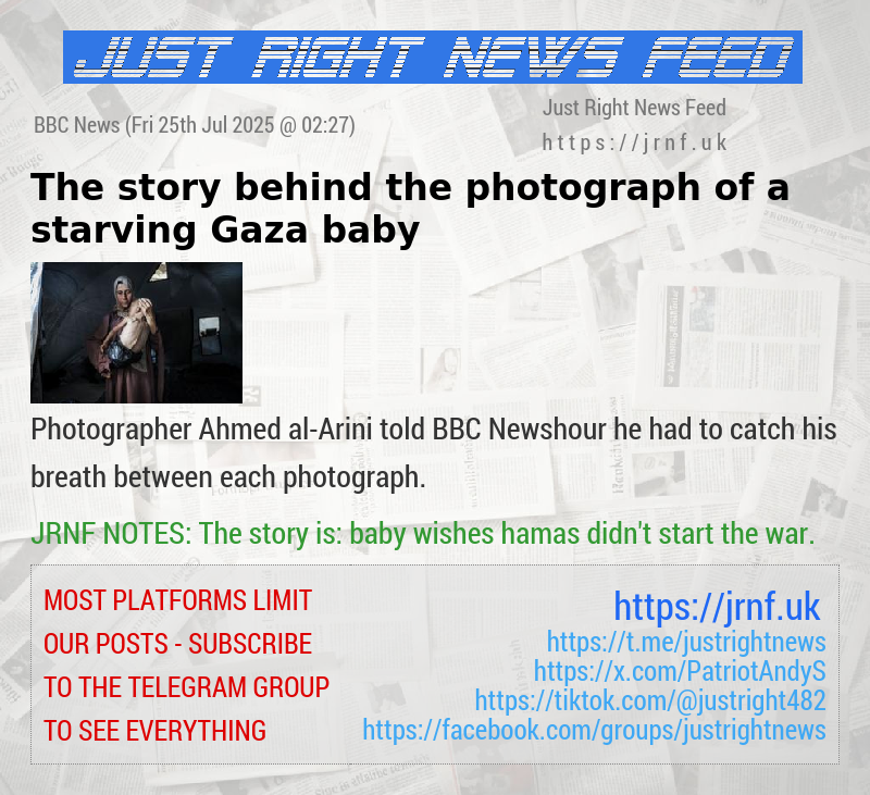 The story behind the photograph of a starving Gaza baby