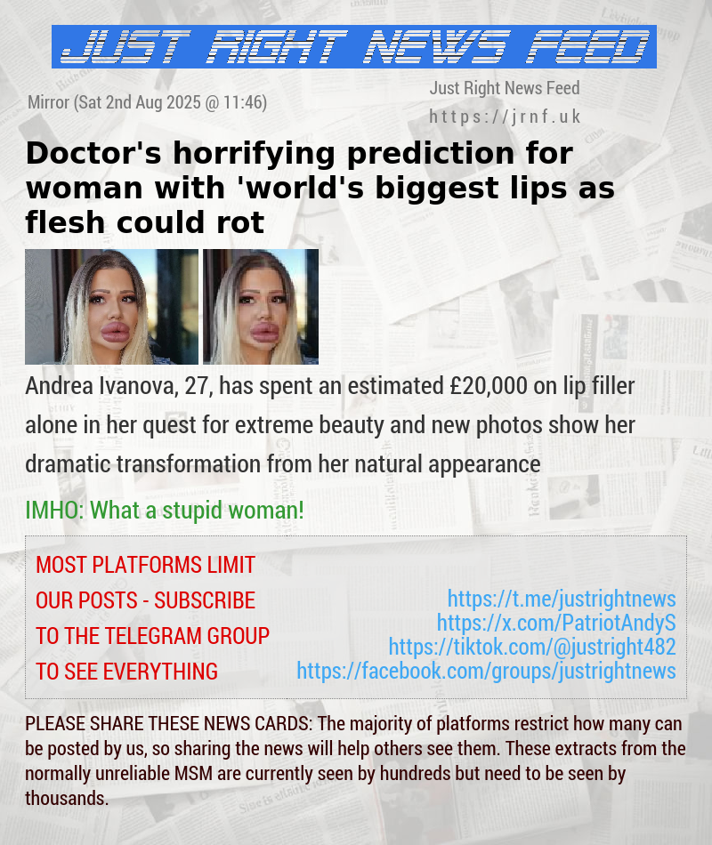 Doctor’s horrifying prediction for woman with ’world’s biggest lips as flesh could rot